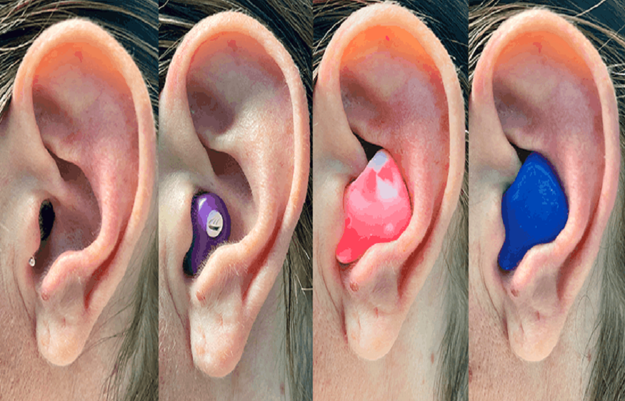 custom earplugs for musicians